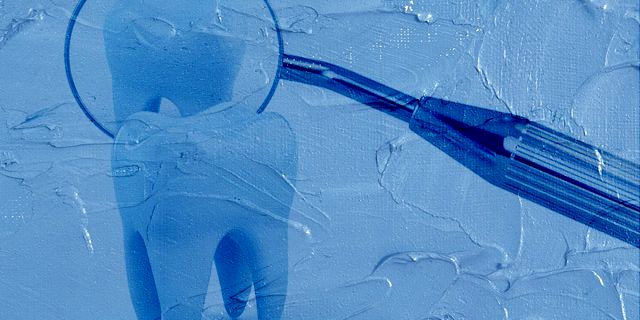 歯科検診に通って歯の健康を保とう